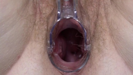 Examining the vagina and cervix. Mature milf hairy pussy